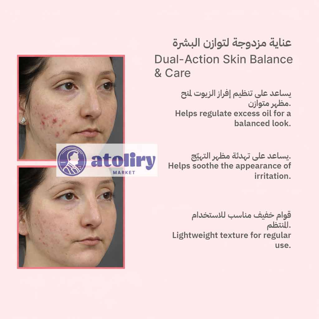 كريم للوجه لتقليل مظهر البثور 40 مل – لبشرة أكثر صفاء - كلاسي